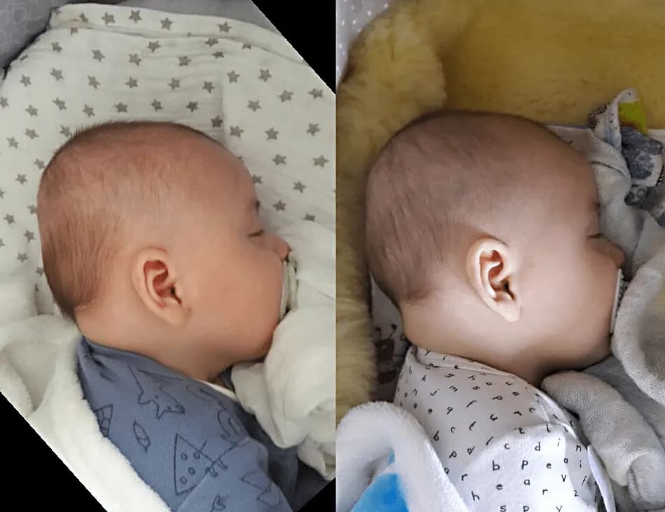 Poduszka kształtująca główkę od kiedy - uniknij deformacji czaszki dziecka Poduszka kształtująca główkę od kiedy - uniknij deformacji czaszki dziecka