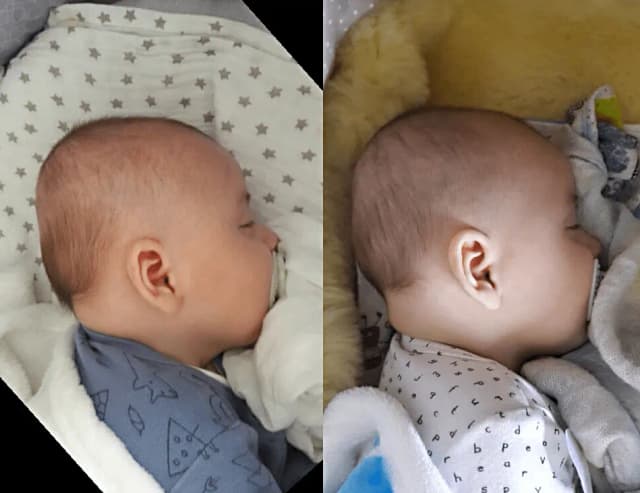 Poduszka kształtująca główkę od kiedy - uniknij deformacji czaszki dziecka Poduszka kształtująca główkę od kiedy - uniknij deformacji czaszki dziecka